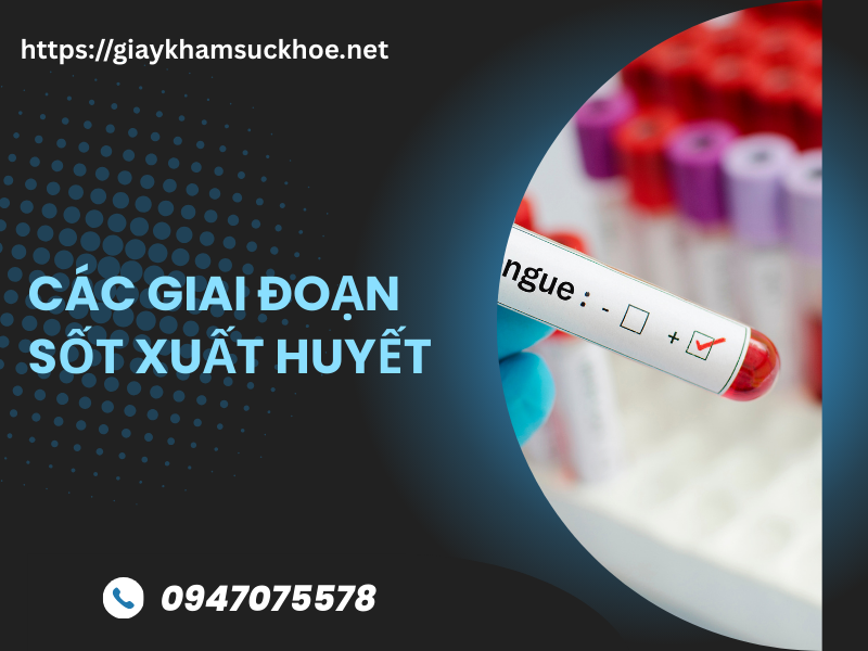 Sốt xuất huyết bao lâu thì khỏi? Các giai đoạn sốt xuất huyết